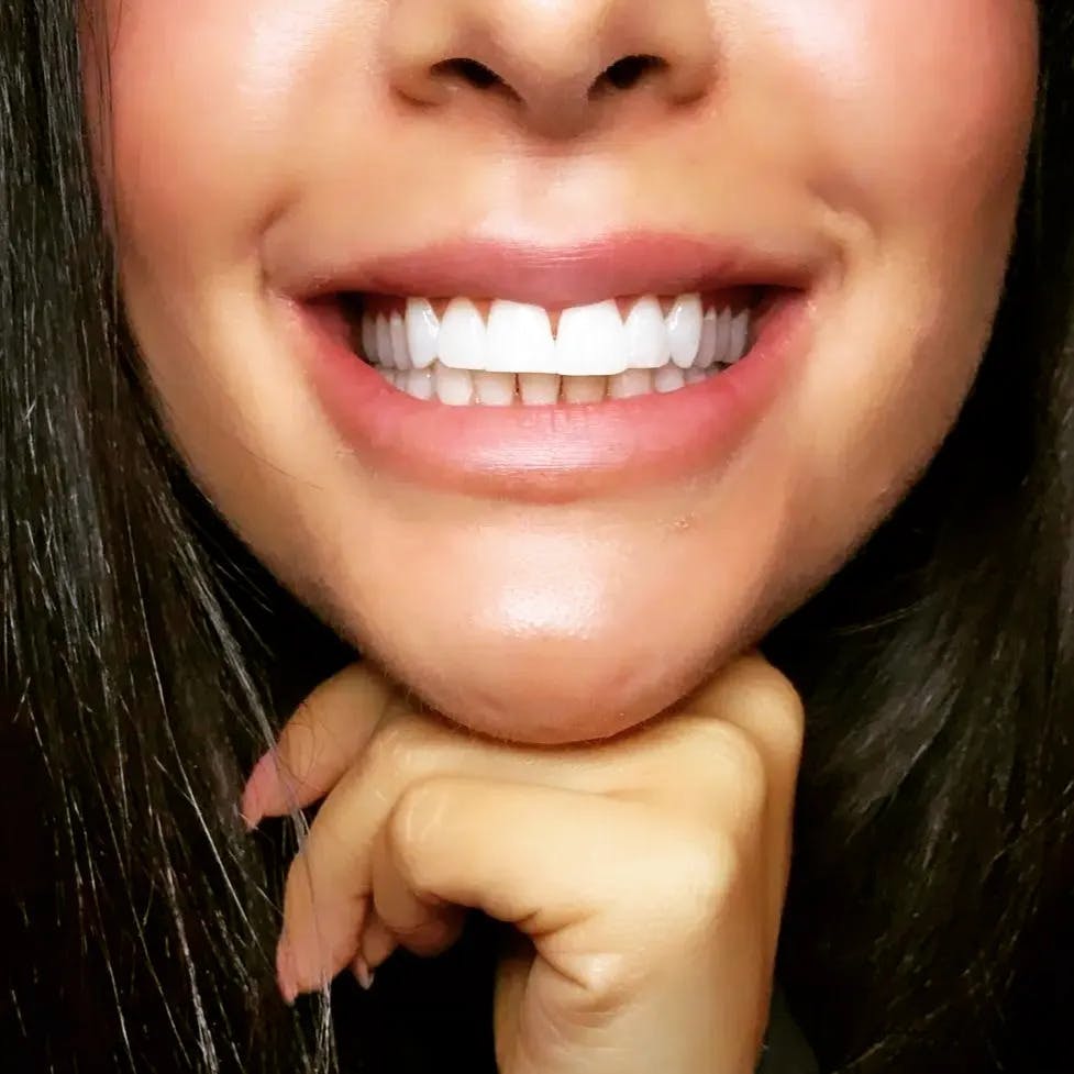 Featured photo from Brighter Smiles Of Davidson
